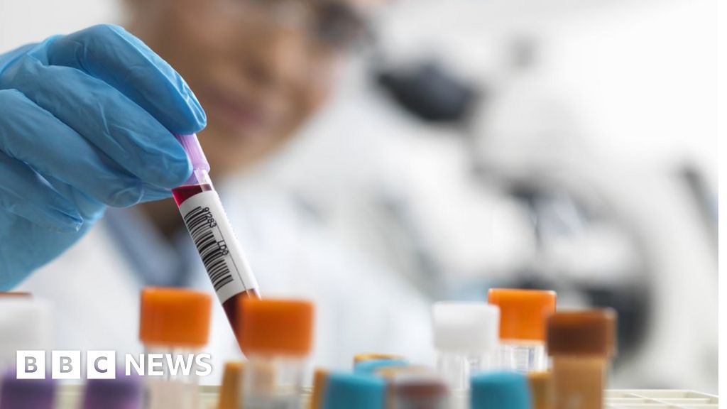 Extra blood test could help spot heart-attack death risk