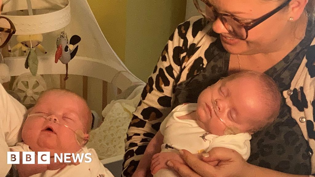 UK’s most premature twins both home with family