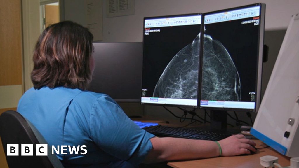 Aberdeen AI trial helps doctors spot breast cancers