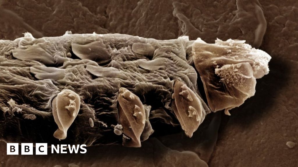 The tiny mites that have sex on our faces have a problem - BBC