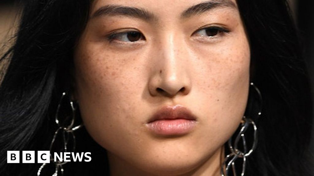 Zara Advert Gets China Asking Are Freckles Beautiful Bbc News 