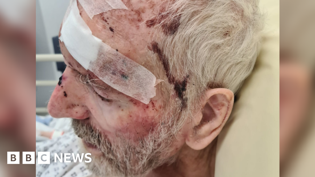 85歲的男子被護理院的同伴攻擊後感到憤怒