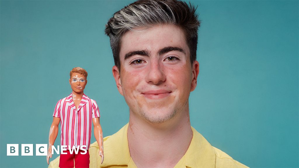 ‘Inclusive Barbies a major step in my life’