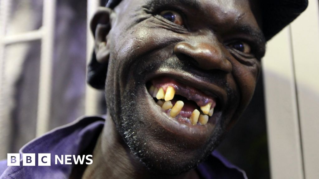 Zimbabwe's Mr Ugly contest winner 'too handsome' - BBC News
