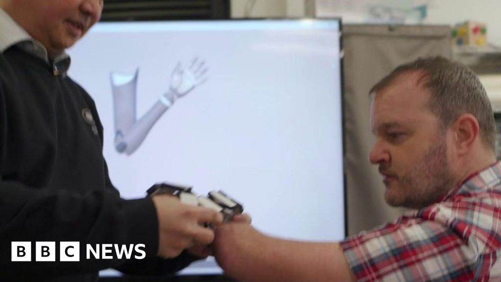 The ‘mind-bending’ bionic arm powered by AI