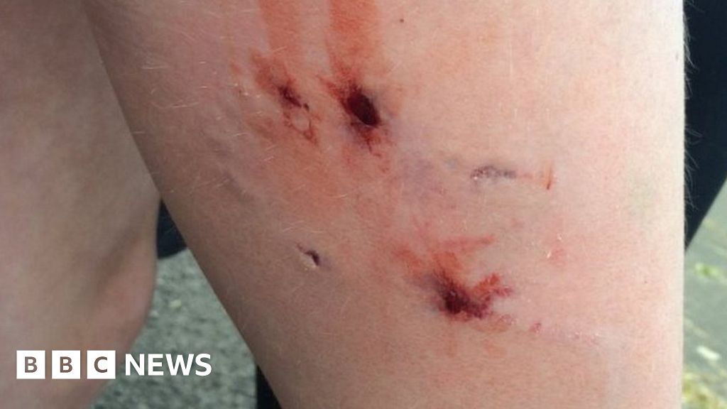 Woman charged after 11 children bitten by dog in Blyth park BBC News