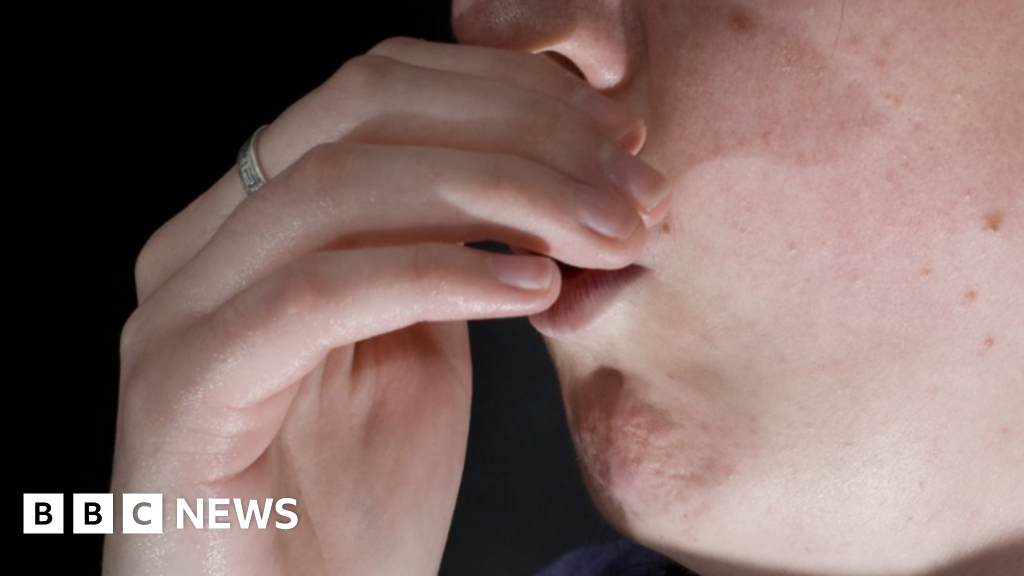 North Cumbria and North East highest for repeat lung admissions North Cumbria and North East highest for repeat lung admissions