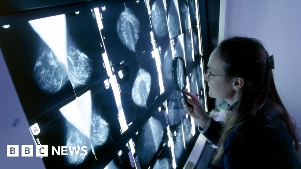 Anger As Breast Cancer Drug Rejected For Scots Nhs Use Bbc News 9893