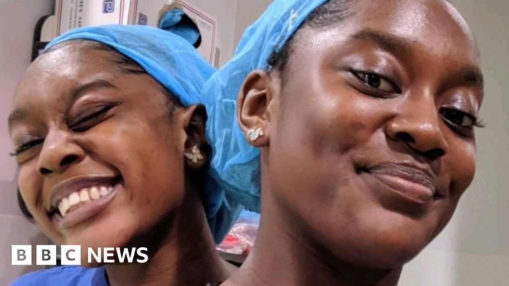 Living a conjoined life - BBC News