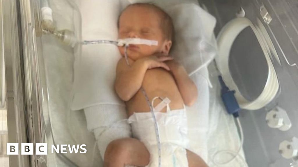 Bill worry for couple after premature baby born in Turkey