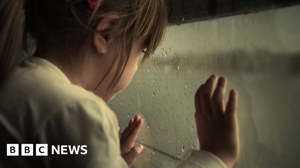 Criminals end up with smaller brains