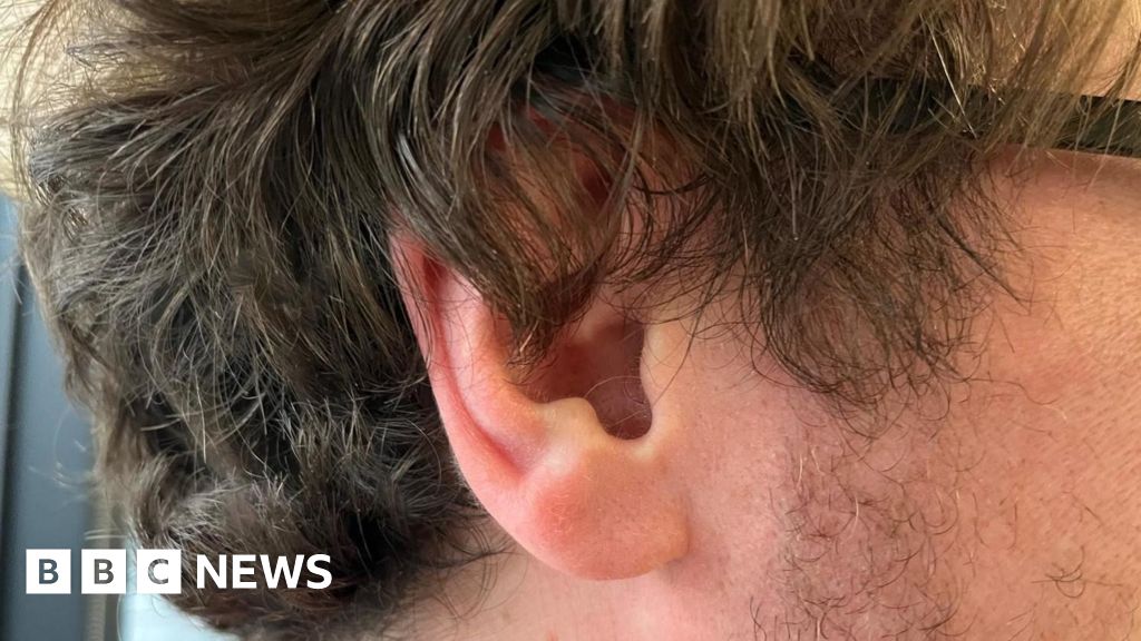 Nueva terapia de sonido de Newcastle University promete aliviar el tinnitus.