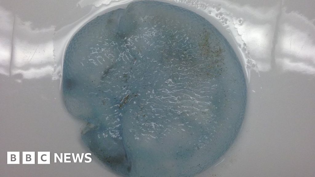Vice Parcel Rustik Australian man's 'breast implant' find revealed as jellyfish - BBC News