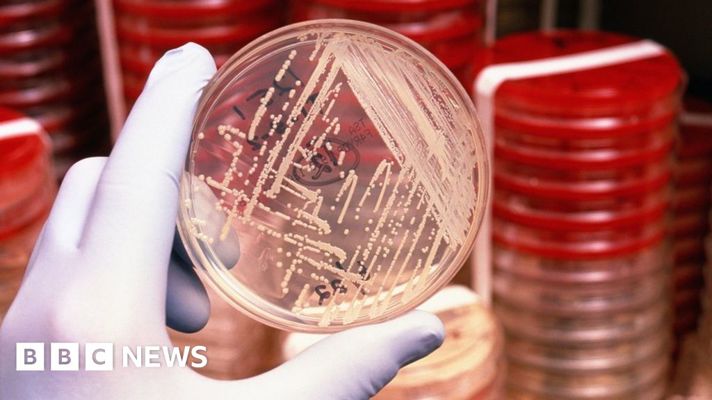 Infections resist 'last antibiotic' in US BBC News