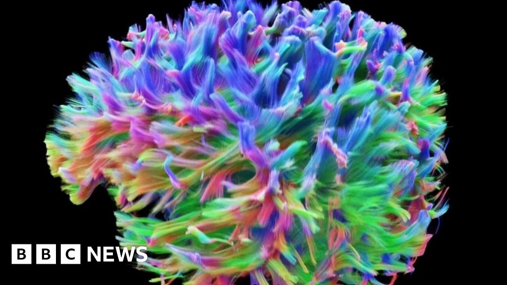 What the brain's wiring looks like BBC News