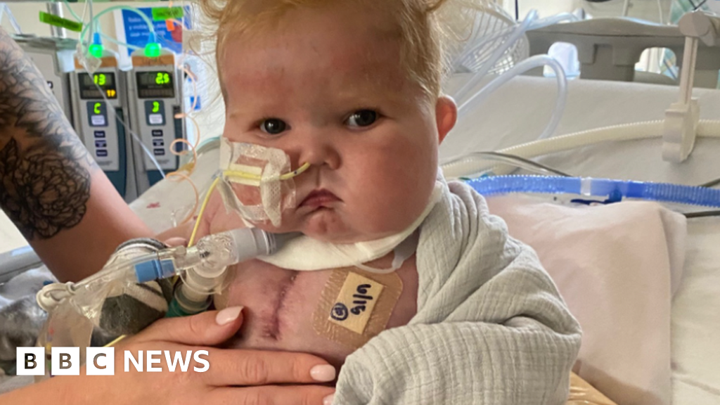 world-first-heart-thymus-transplant-success-for-easton