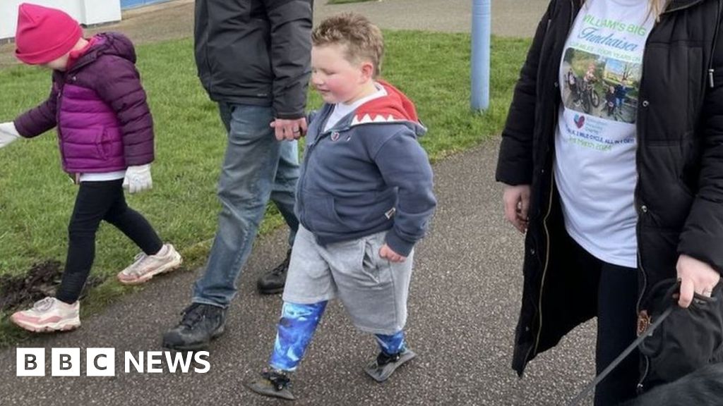 Huthwaite Charity walk for boy who lost legs after sepsis