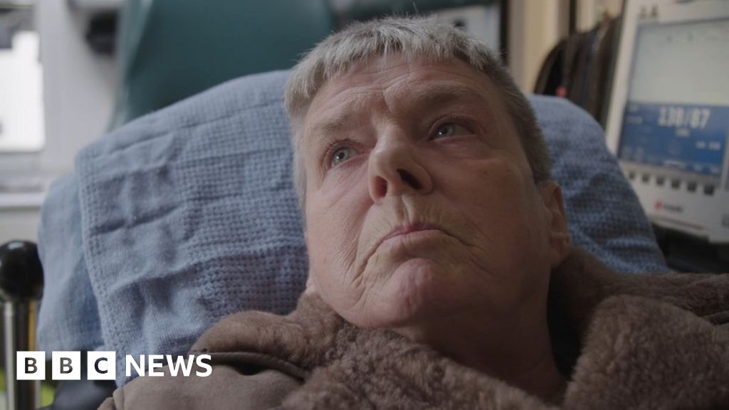 NHS: Wales' hospital treatment time longest in UK - study