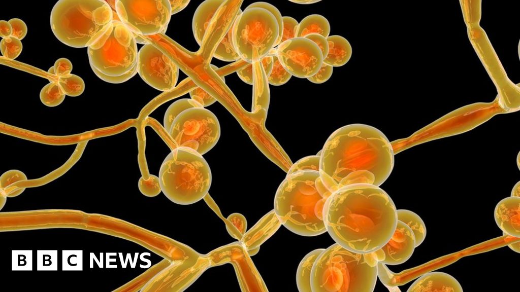 Candida auris: The new superbug on the block - BBC News thumbnail