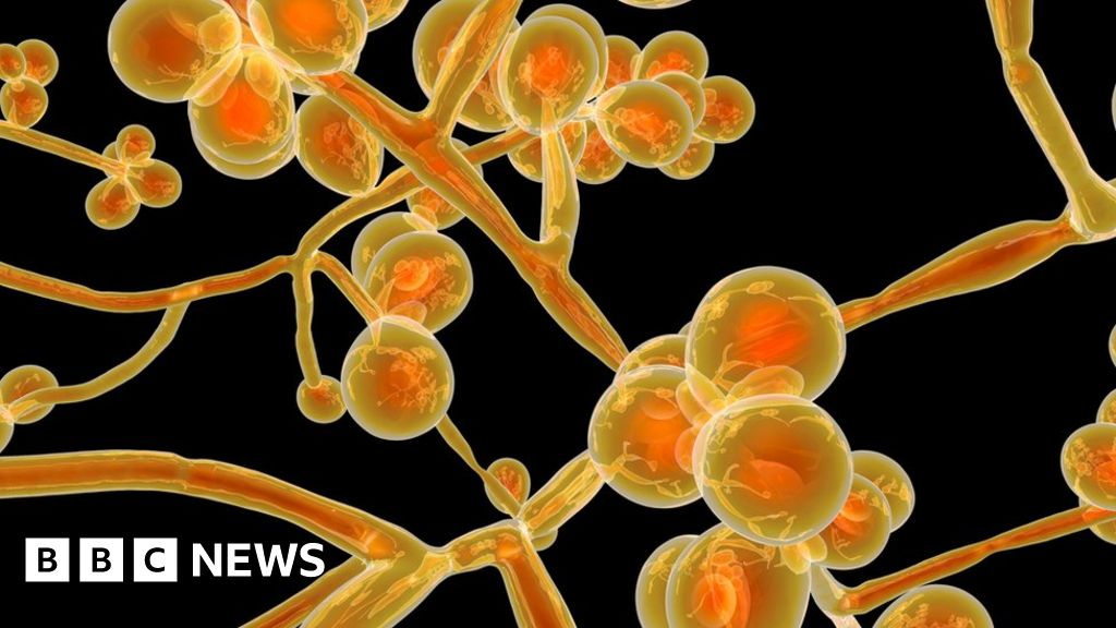 Candida auris: The new superbug on the block