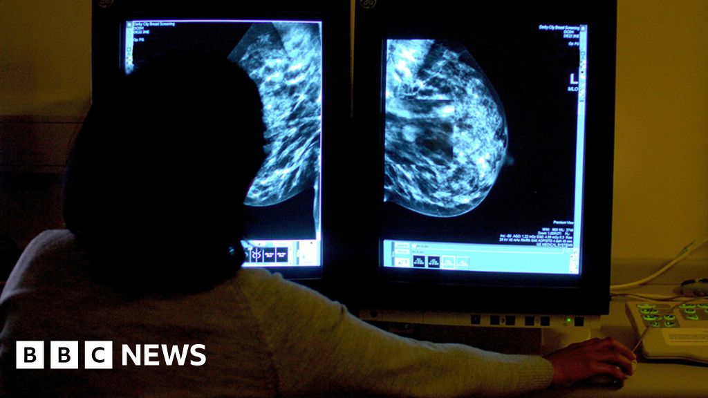 University of Sheffield researching new drugs for breast cancer