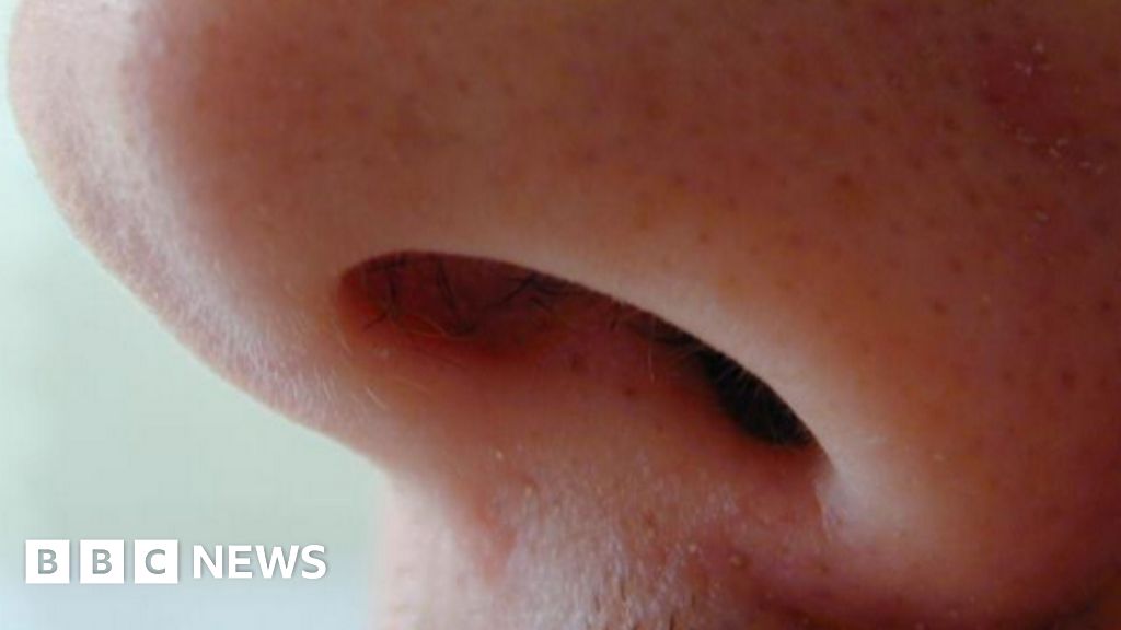 bbc.co.uk - Stuart Harratt - Hull hospitals offer new medical treatment for blocked noses