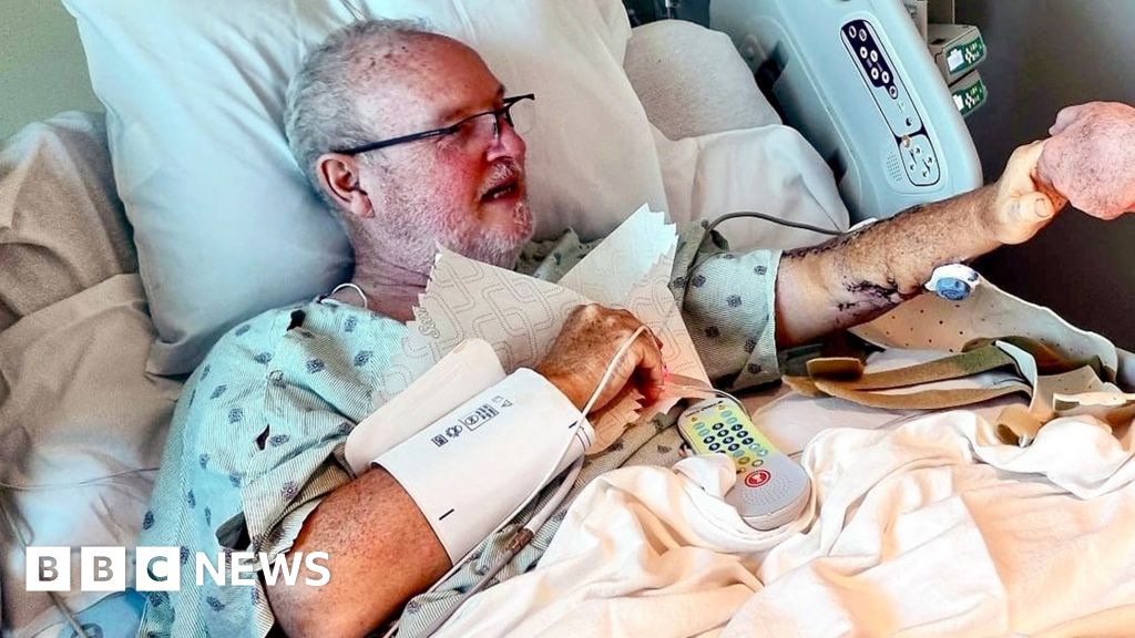 British man tells BBC of horror shark attack on Caribbean holiday thumbnail