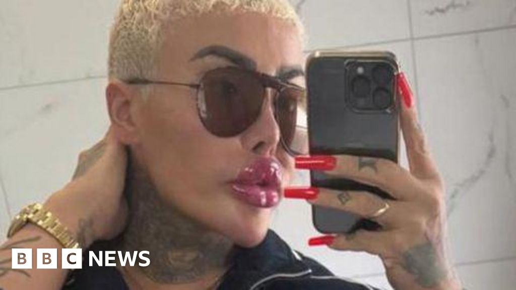 Two arrested after death of 'British Lip King'