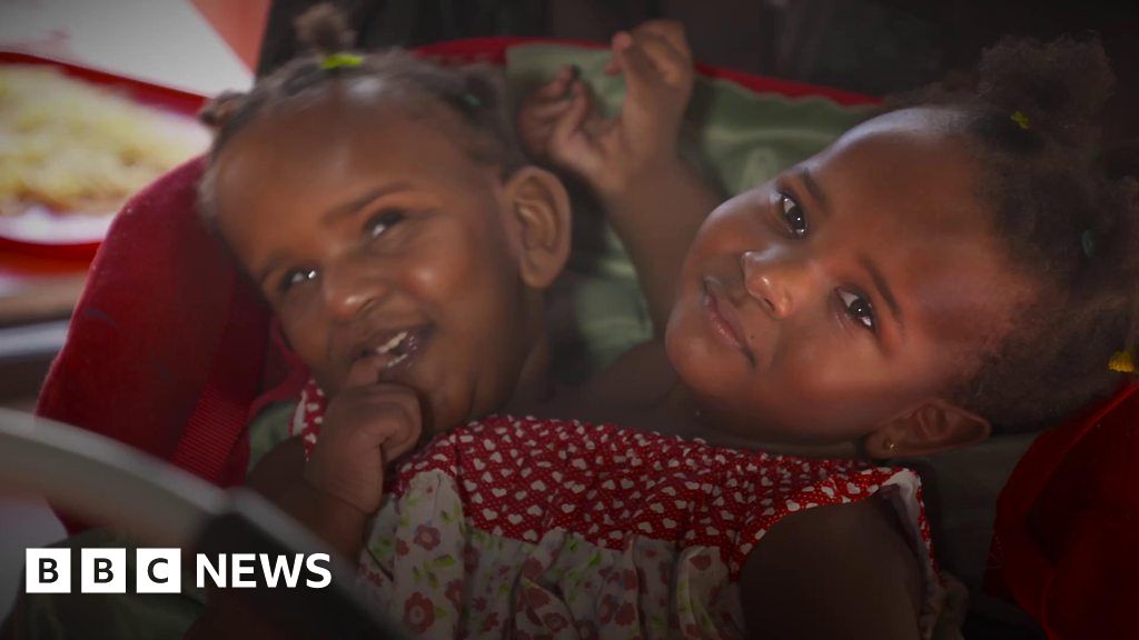 Conjoined Twins Marieme And Ndeye Ndiaye Are Living In The Uk Bbc News 1872