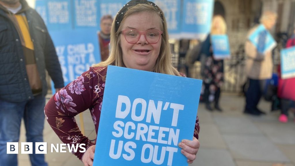 Woman with Down’s syndrome loses abortion law appeal
