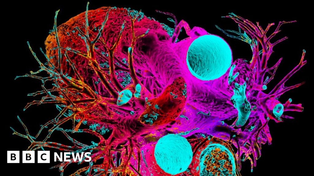 Pig heart kept beating in baboon for over two years BBC News