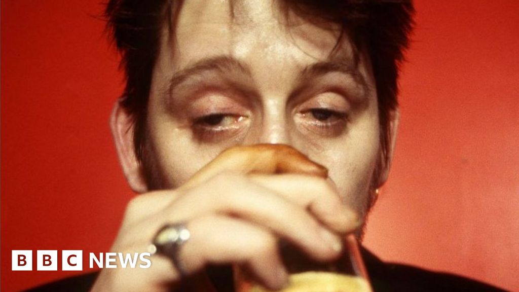 The Pogues' Shane MacGowan made a documentary about his new set of chompers