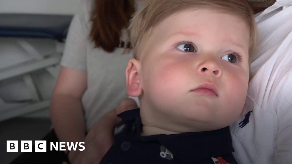 'There is no treatment for measles'
