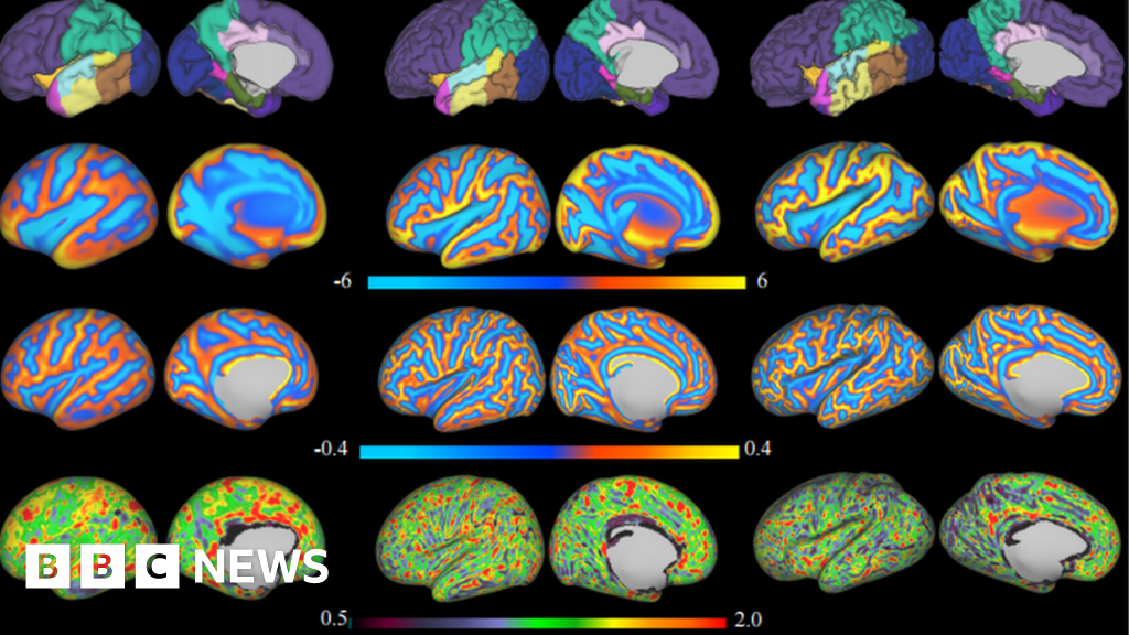 Baby brain scans reveal trillions of neural connections BBC News