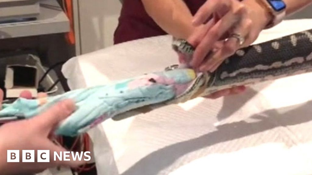 Snake eats towel: A vet explains her strangest day at work