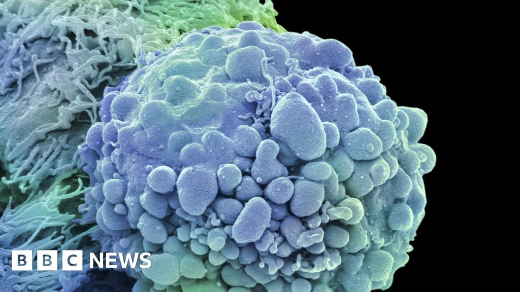 'Softener' may help kill cancers BBC News