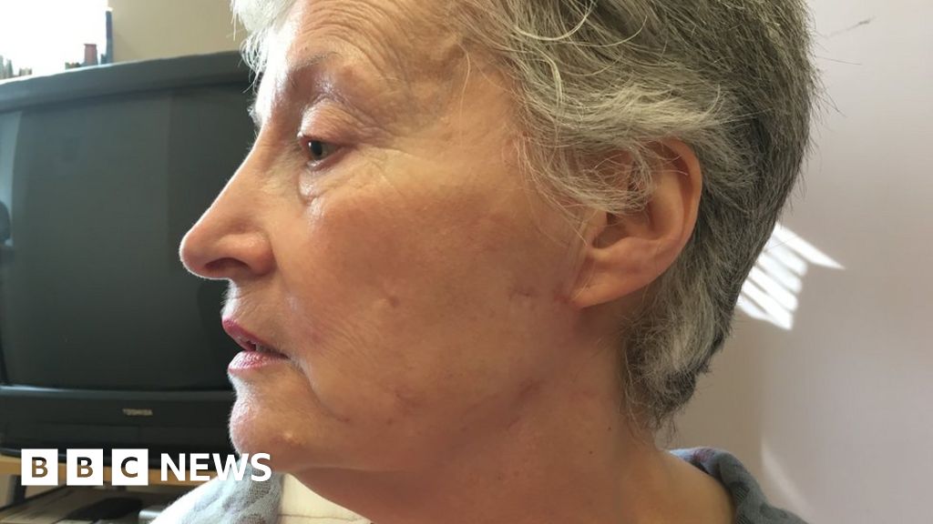 'Turn to God' grandmother stabbed in head tells robber BBC News