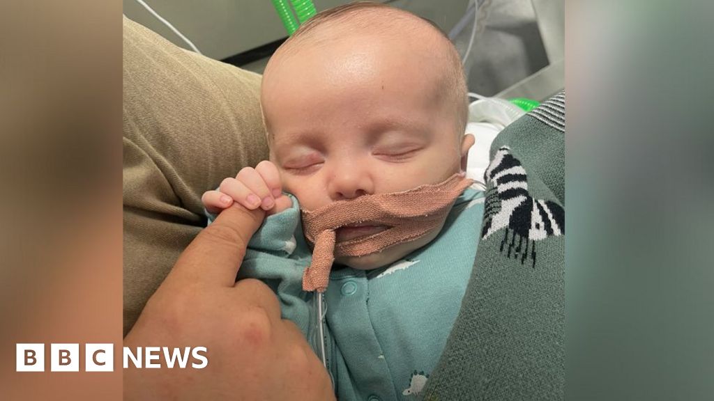 Baby's parents make plea for heart transplant