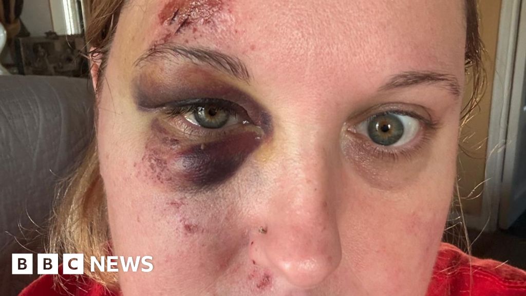 Injuries, blown tyres and repair bills - frustration over 'spike' in potholes