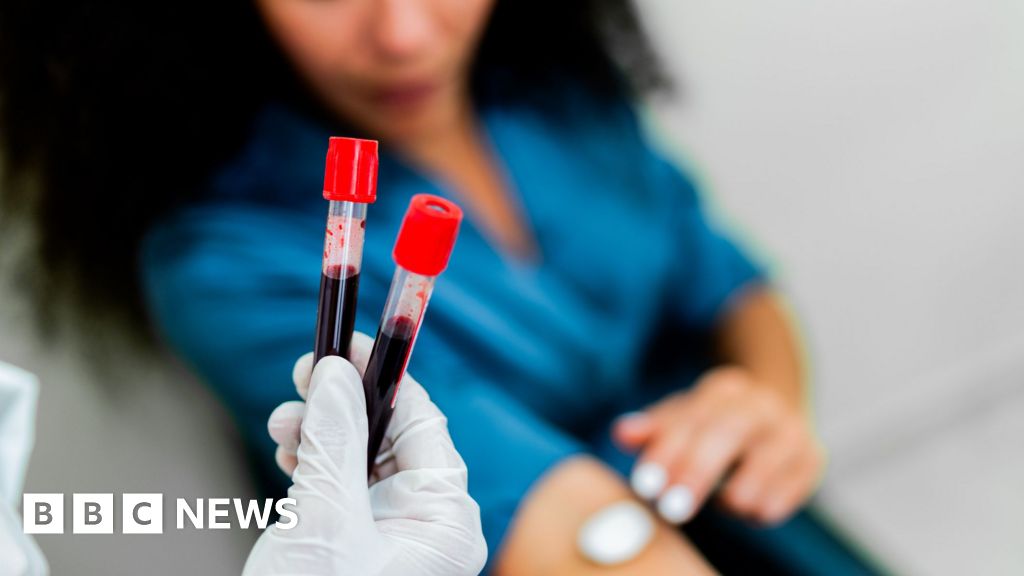 Exciting results from blood test for 50 cancers