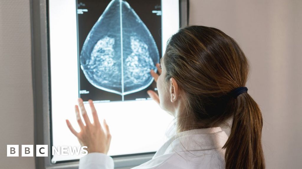 AI: Researchers train artificial intelligence to help detect breast cancer