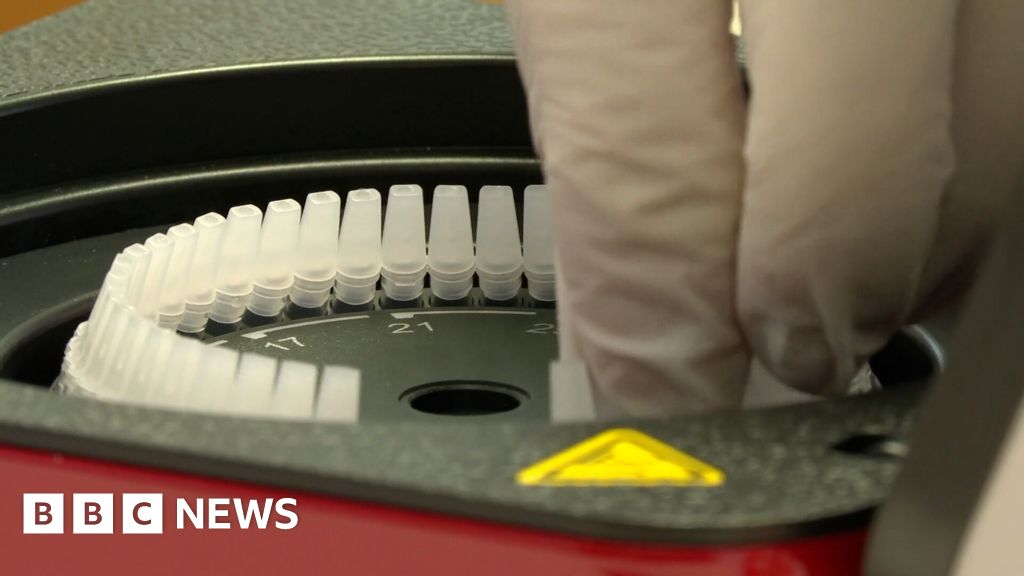 Covid: Omicron 'causing more Guernsey coronavirus reinfections' - BBC News