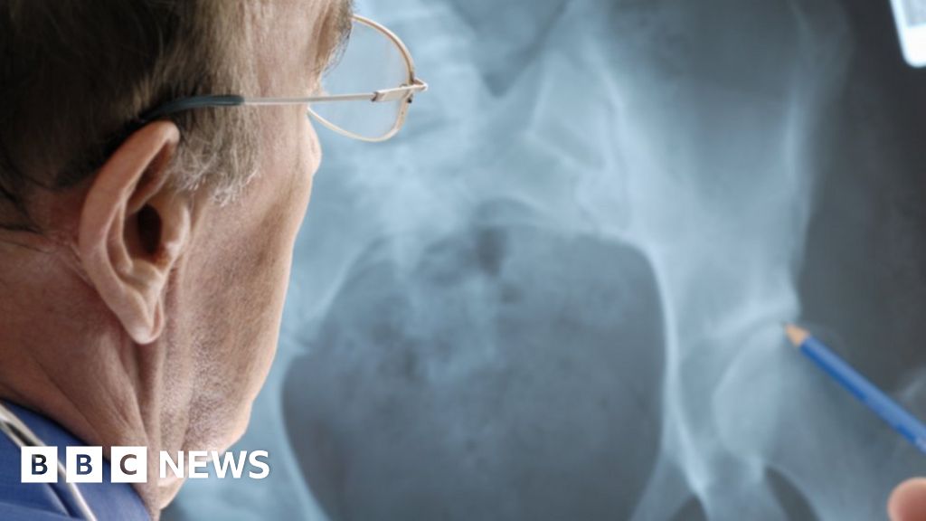 Hip Implant Patients Sue Manufacturer Bbc News