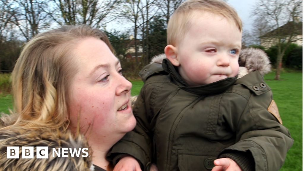 Toddler's eyeball sliced in half by drone propeller