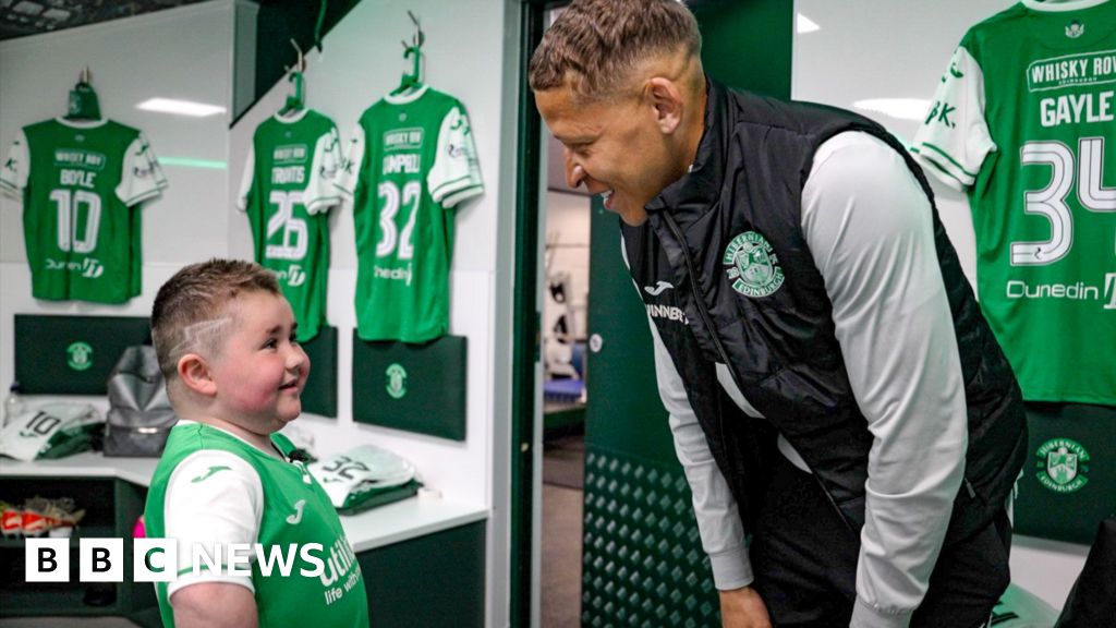Boy waiting for life-changing drug meets Hibs football heroes