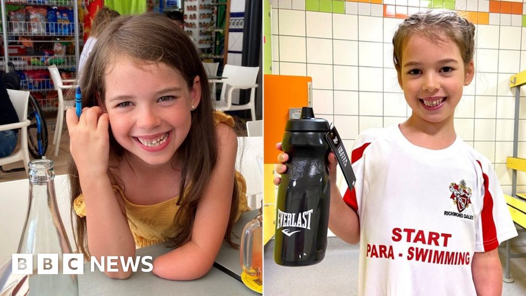 Children with limb difference to get 'life-changing' prosthetic arms