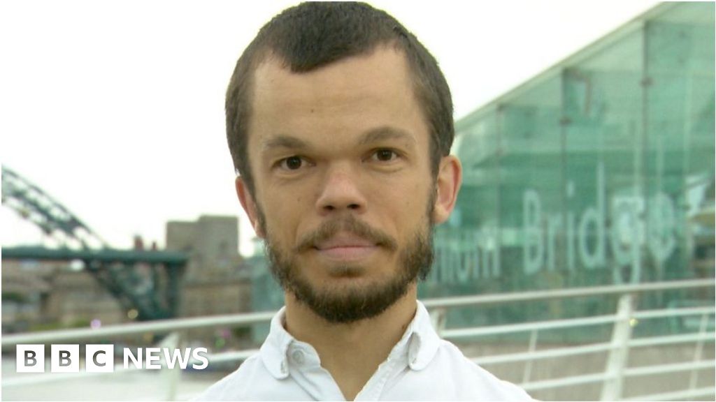 Man with dwarfism describes street abuse