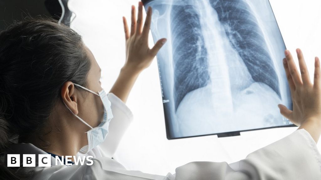 Nottingham: Rare Lung Disease Research Centre To Give Patients 'hope 