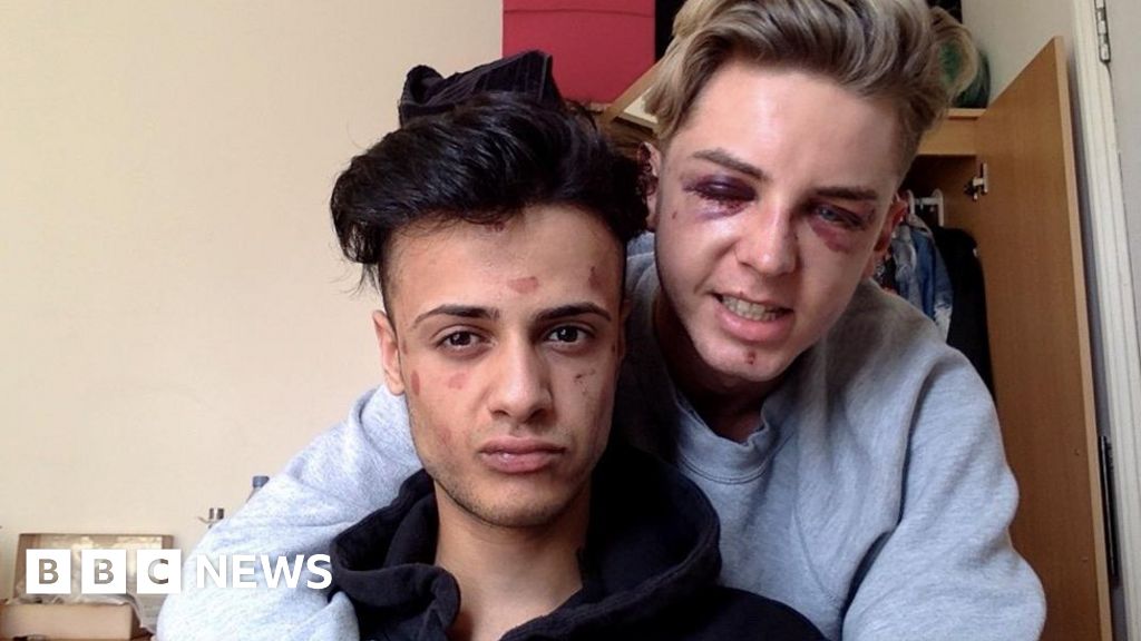Beaten Up For Being Gay Bbc News