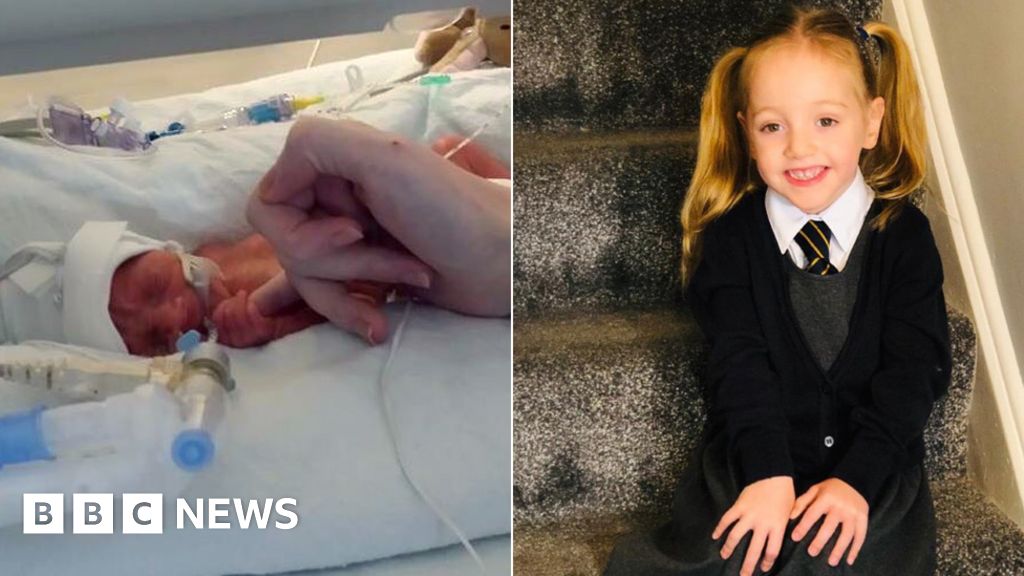 �Miracle� baby born at 25 weeks starts school in Coventry